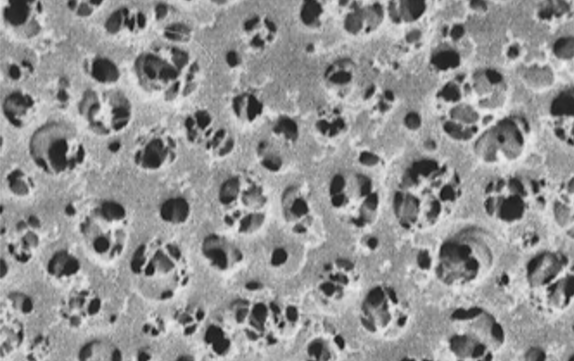 Filtros de membrana de acetato de celulose